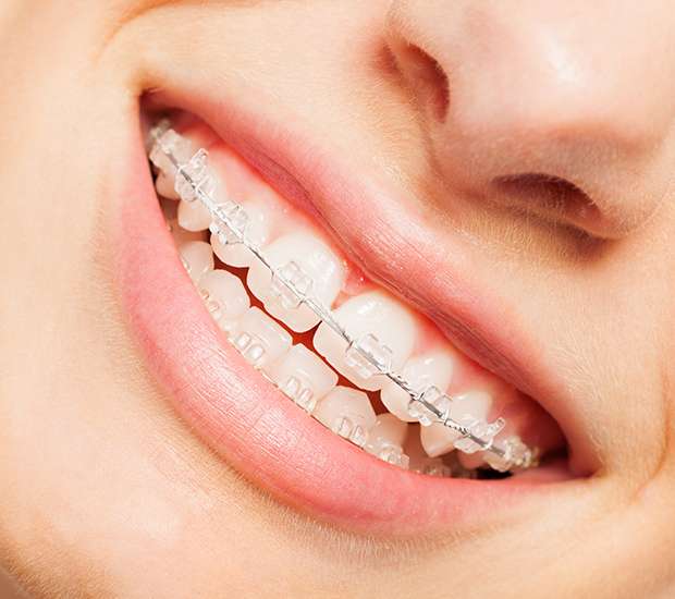 Brooklyn Invisible Orthodontics