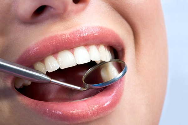 Modern Dental Fillings: Natural Look, Long Lasting Results