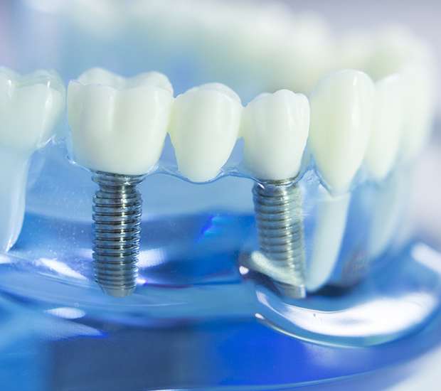 Brooklyn Dental Prosthetics