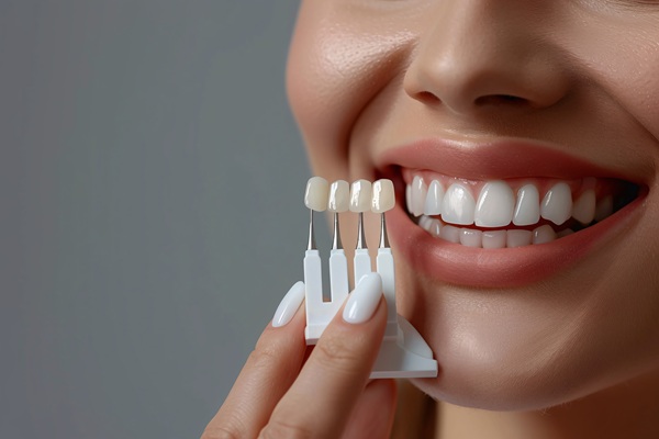 Surprising Benefits Of Getting Dental Veneers