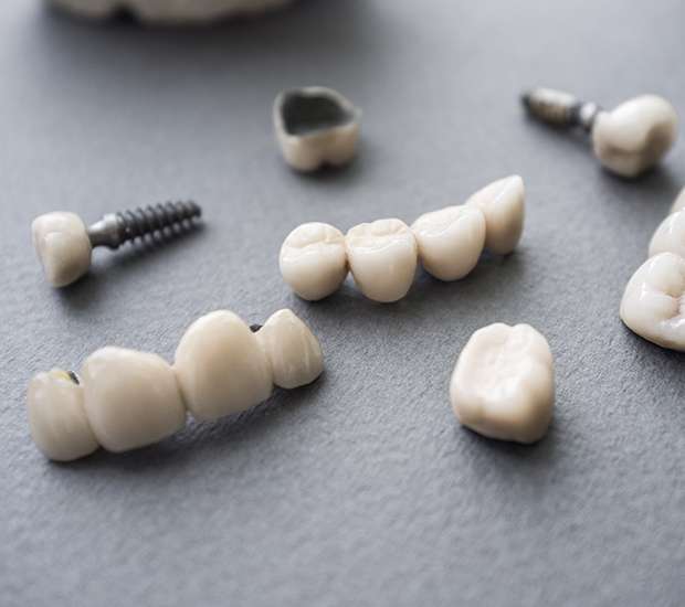 Brooklyn The Difference Between Dental Implants and Mini Dental Implants