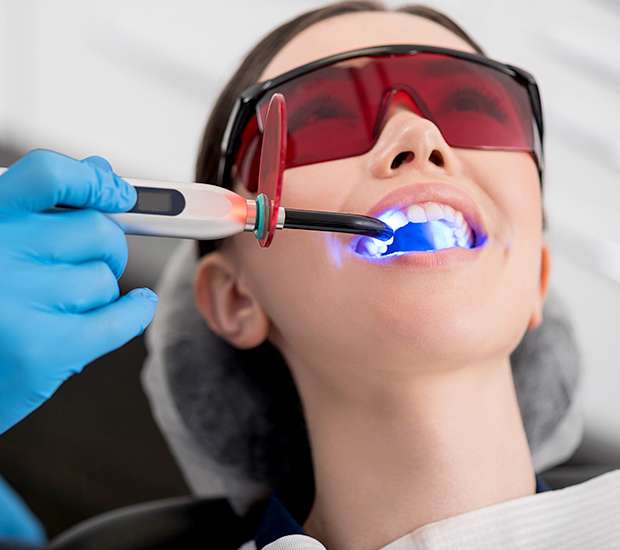 Brooklyn Professional Teeth Whitening