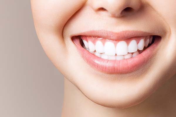 How Fluoride Can Relieve Sensitivity After Teeth Whitening