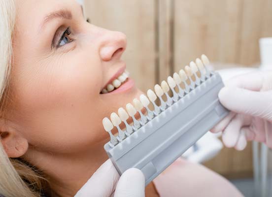 What Are Veneers Made Of?