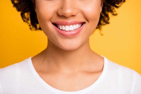 Who Is A Good Candidate For Veneers?